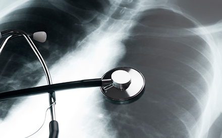 chest x-ray with stethoscope on top